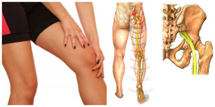 πόνος στην πλάτη και το πόδι θεραπεία